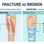 fracture vs broken