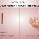 iud vs pill